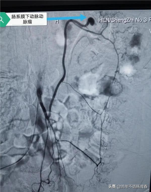双胞胎鉴定同母异父,双胞胎鉴定同母异父视频完整版
