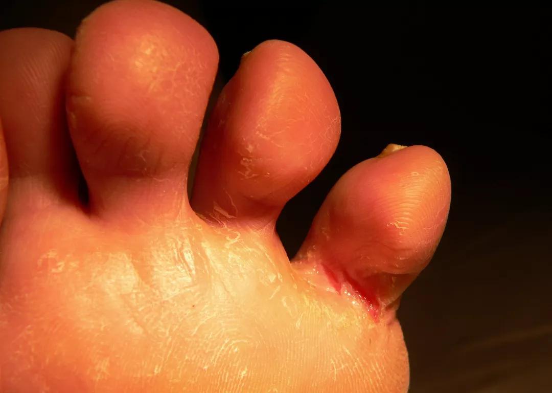 袜子裤头可以一起机洗吗,袜子和裤袜能一起洗吗