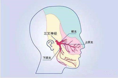 牙痛可以把全部牙齿拔了吗,牙齿拔了一个月了牙齿现在还痛