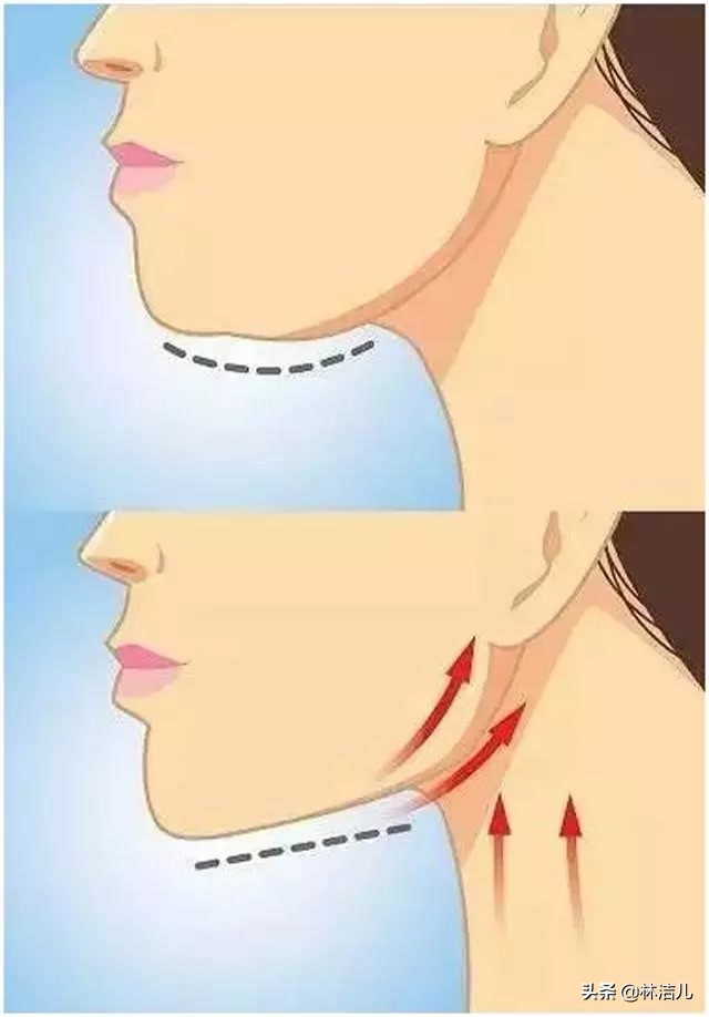 方脸如何变成鹅蛋脸教程,如何将方脸整成高级脸