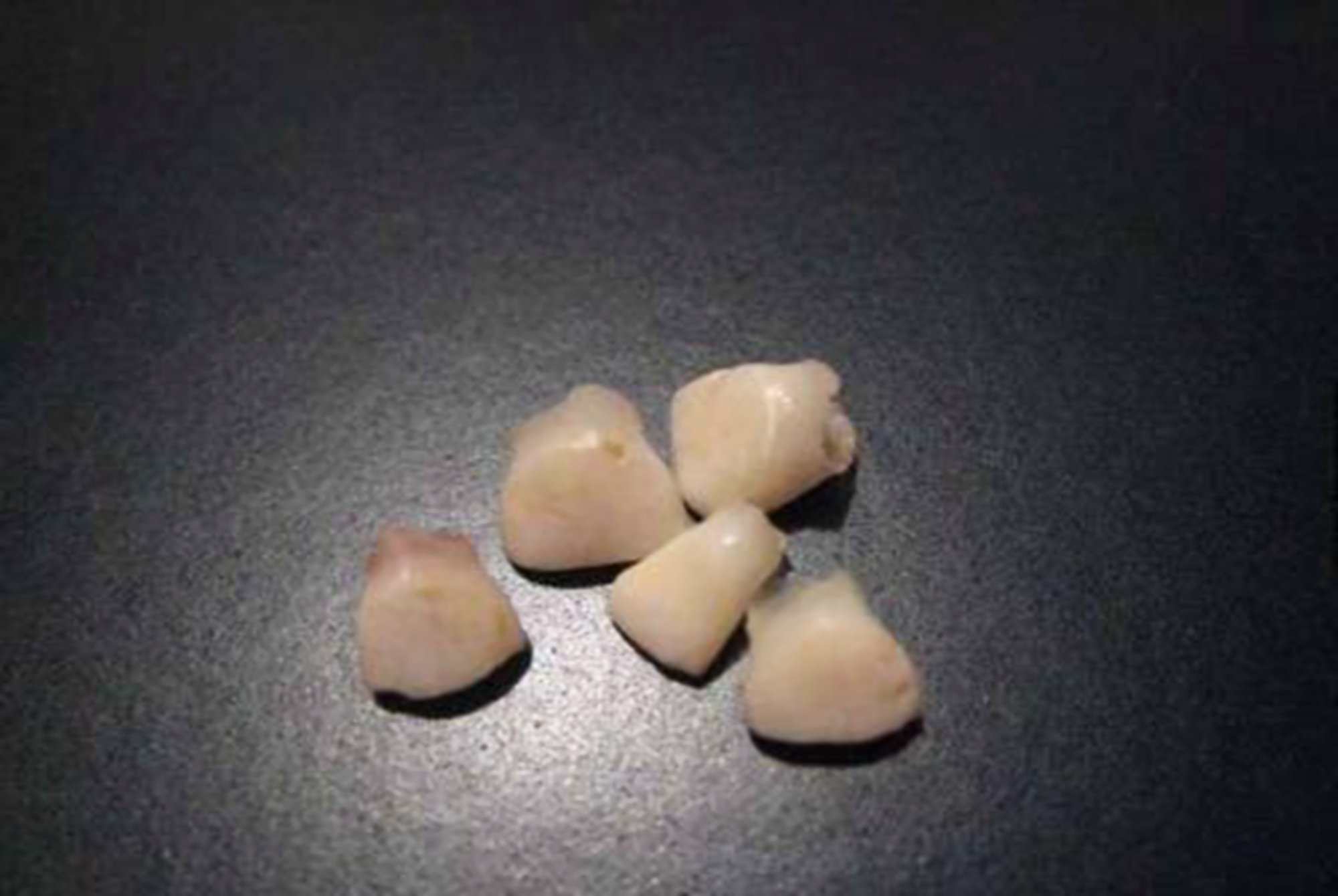 宝宝掉牙了应该怎么处理,宝宝掉牙了怎么办小视频