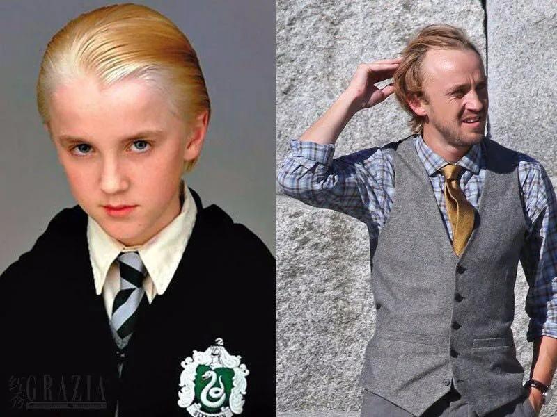 小贝为何剃光头,贝克汉姆的头秃