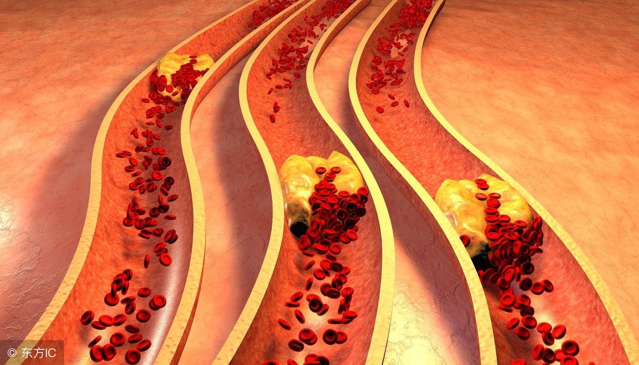 黑豆有降糖效果吗,黑豆怎么吃降糖效果最好