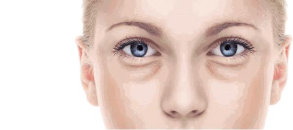 有眼袋泪沟化妆画卧蚕好看吗,泪沟跟卧蚕跟眼袋怎么区分