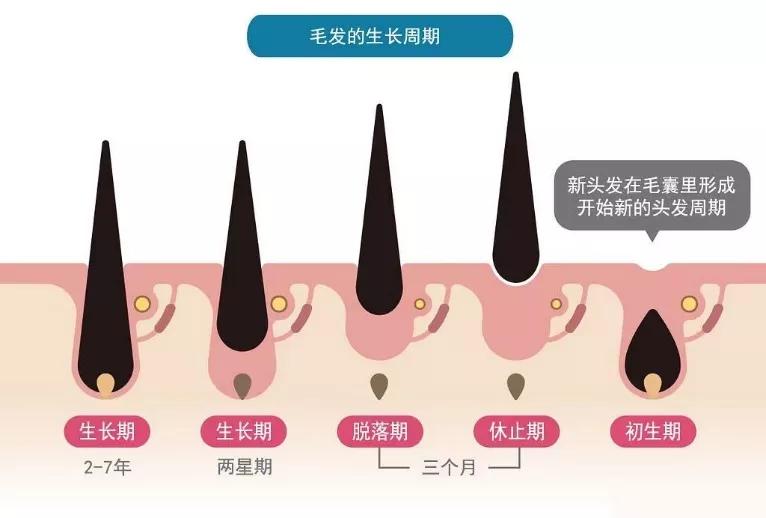 生孩子以后头发掉得厉害怎么办,生了孩子头发掉了怎么长回来