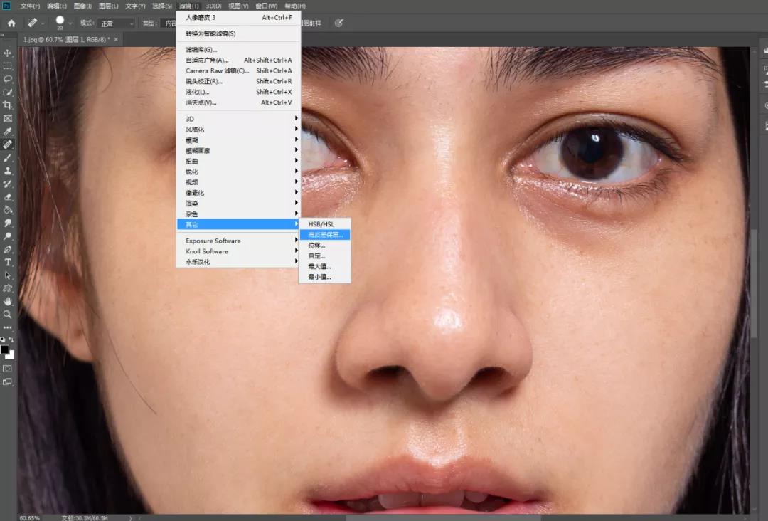 照片有黑眼圈怎么去除,照片怎么加黑眼圈