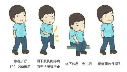 血管堵塞脚先知,脚毛细血管堵塞的十大征兆