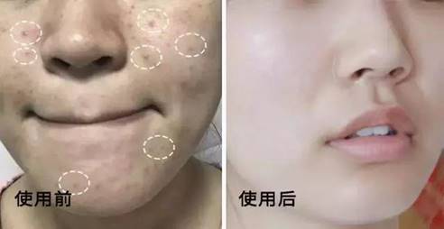 2019上黑名单的洗面奶前十,洗面奶黑名单