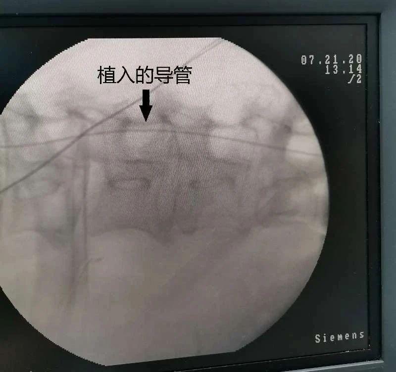 苏州九龙医院阑尾炎手术,苏州九龙医院肿瘤