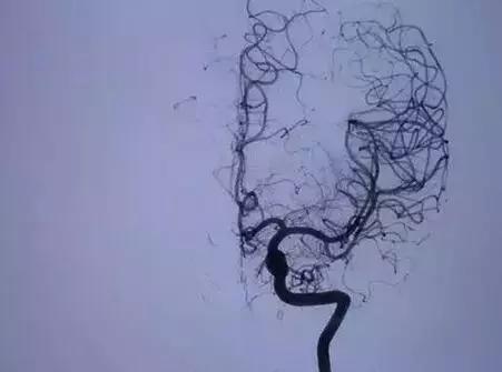 x光b超ct核磁共振区别,ctx光和b超核磁共振的区别