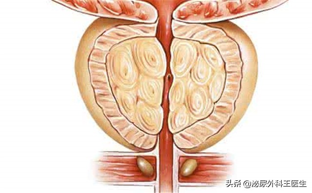 肛门潮湿瘙痒是体湿吗,湿气重也能引起肛门外潮湿瘙痒吗