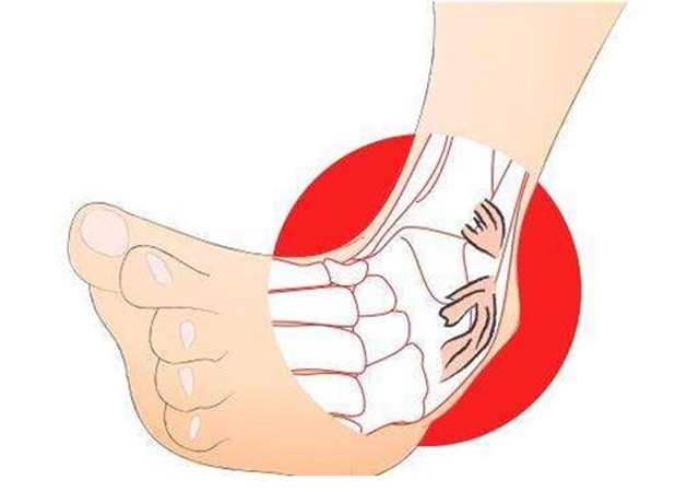 崴过一次脚很容易再次受伤,孩子第一次崴脚你重视了吗