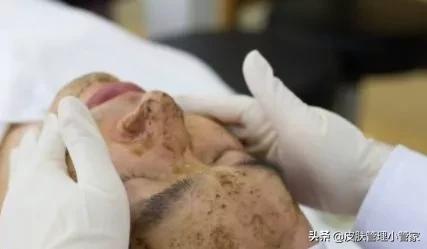 祛斑祛痘皮肤管理,皮肤管理祛痘有效吗