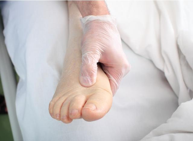 孕期腿脚浮肿有什么办法,孕晚期脚肿成猪蹄了怎么缓解