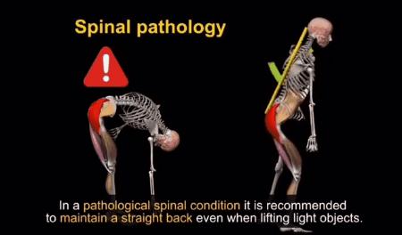 髋发力动作模式,髋骨疼痛的动作怎么练