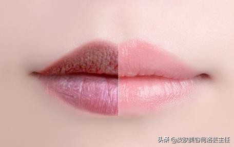 唇色发紫和唇色深,唇色深怎么办四大技巧改善唇色深