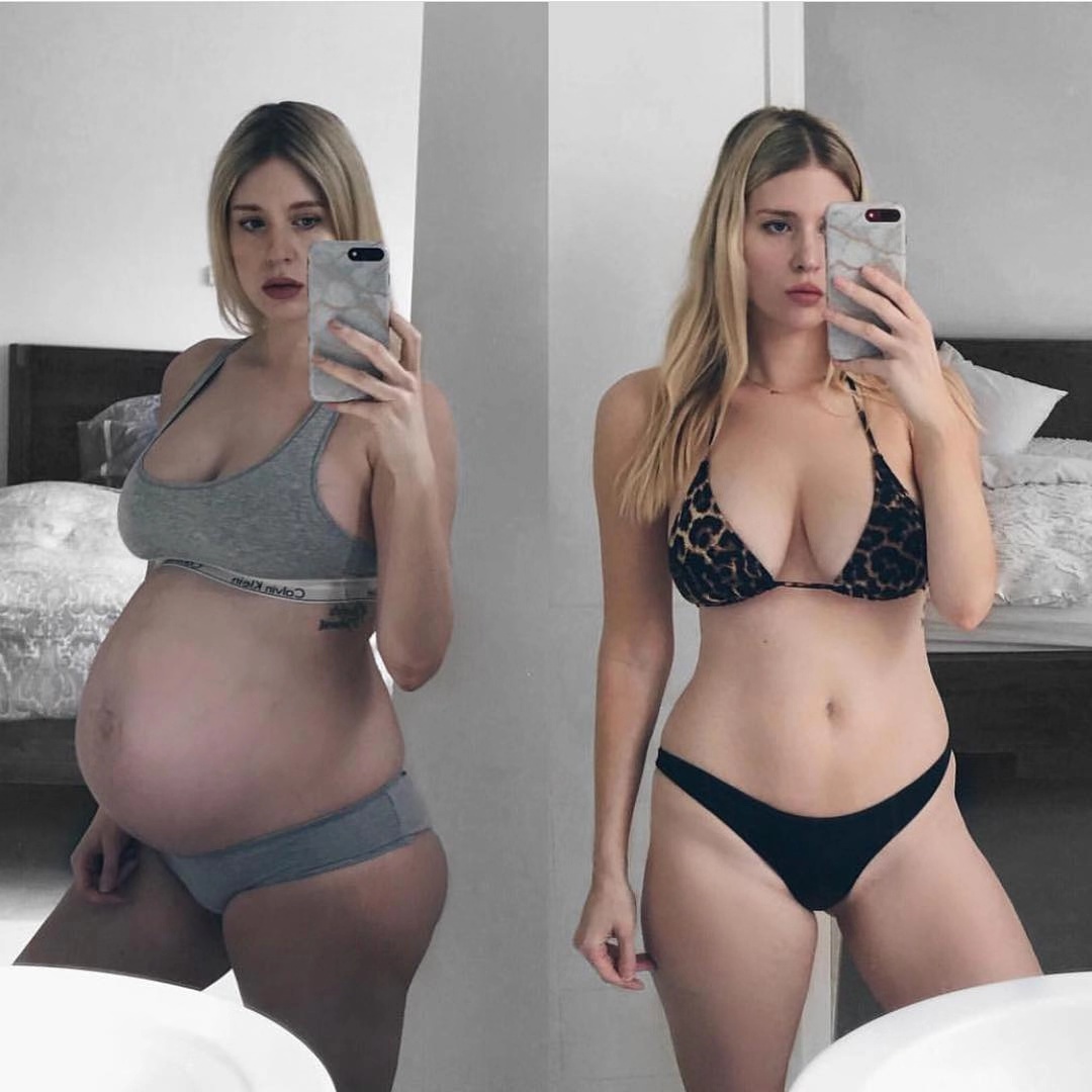 如何避免出现妊娠纹这5步要做好,怎么预防妊娠纹的发生