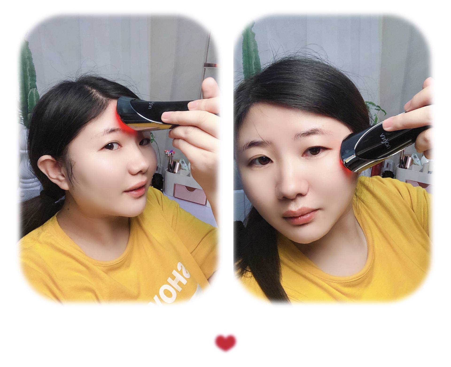 anjou射频仪,anjou美容仪测评