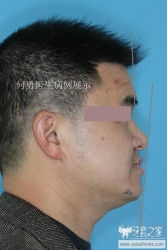 正畸医生如何指定方案的,正畸医生怎么说