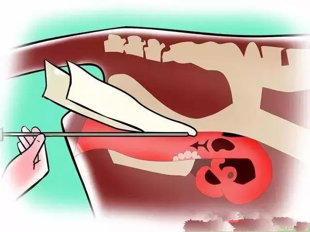 给母牛人工授精的步骤,给牛人工授精注意哪些