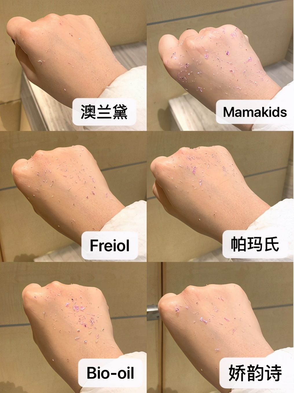 长妊娠纹怎么办补救产后快速消除,祛妊娠纹小窍门去除产后妊娠纹