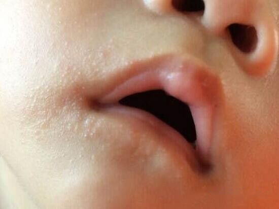 宝宝不停的摇头是啥意思,宝宝莫名其妙的摇头是什么情况