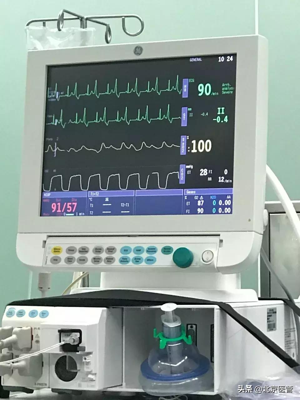 宫外孕大出血抢救无效死亡,成功救治宫外孕大出血休克