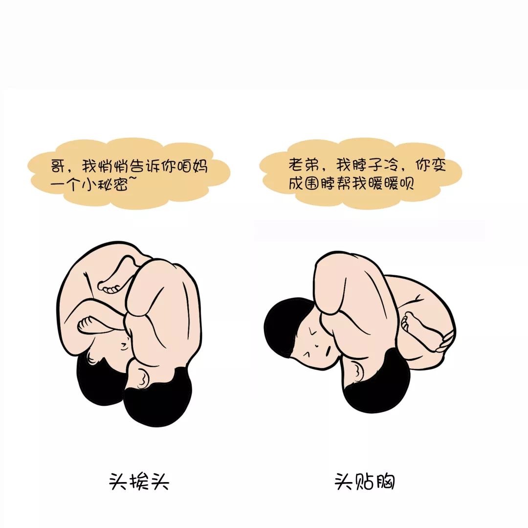 双胞胎孕妇大揭秘,双胞胎的深度解析