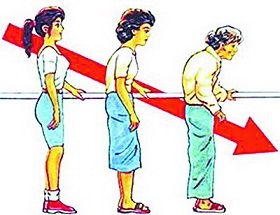 早绝经会得乳腺癌吗,早绝经老了会得老年痴呆症吗