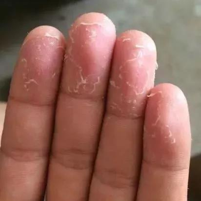 日本削土豆手套,去皮刮鱼鳞神奇手套