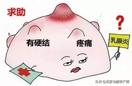 乳腺炎的预防和治疗方法。