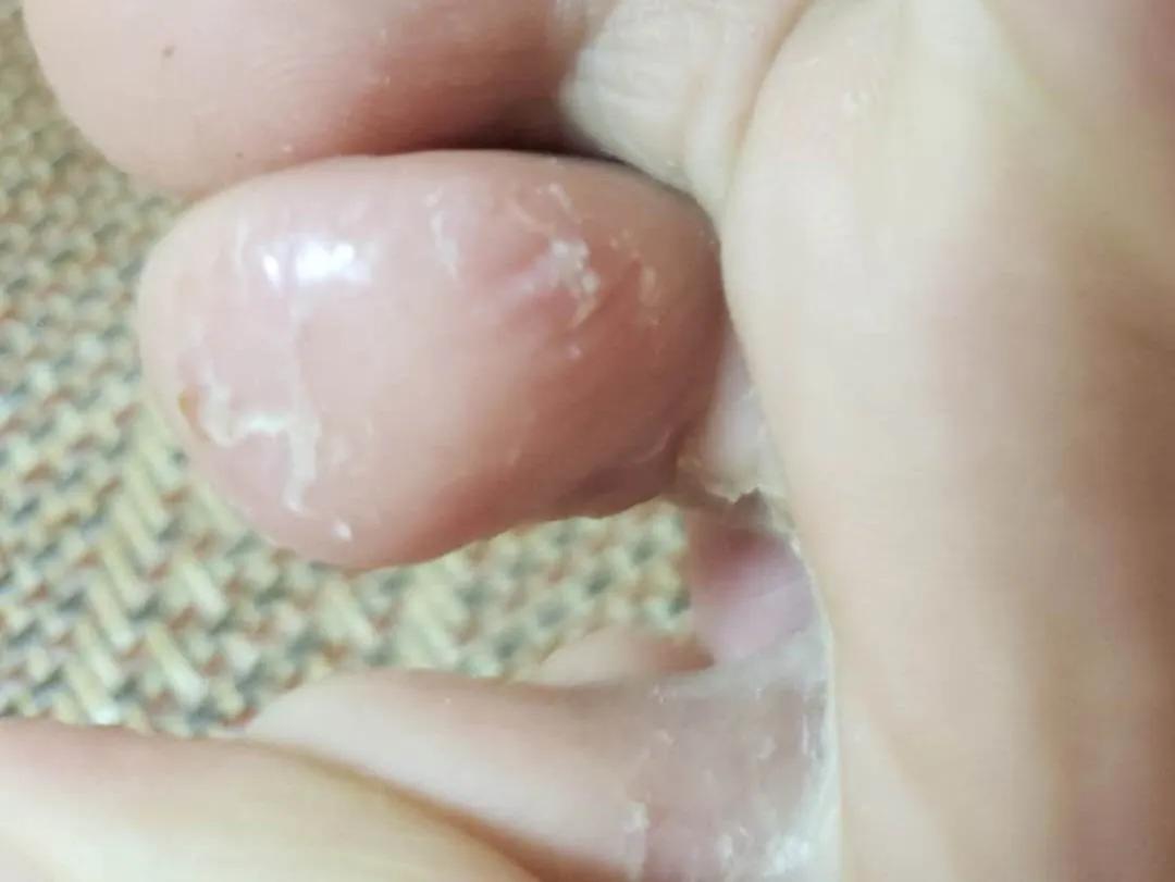 沈腾有脚气吗,沈腾治疗强迫症