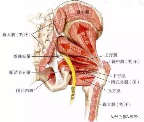 咳嗽引发坐骨神经痛啥原因,坐骨神经痛是什么原因引起的男士