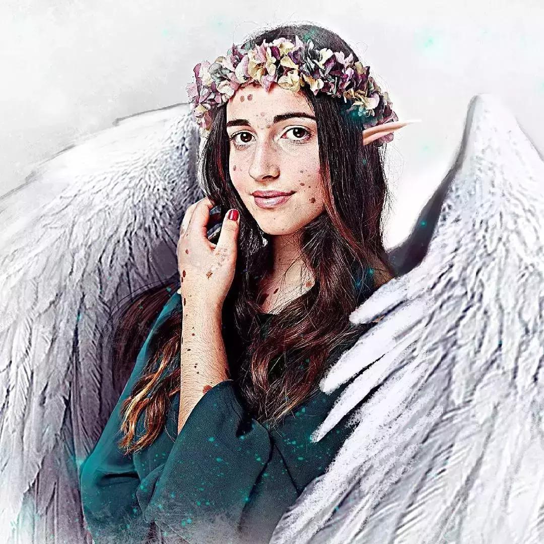 全身黑斑被骂“斑点狗”，身高160的她却成为最美超模…