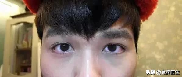 中医专家阴虚是什么意思啊,中医阴虚火旺型失眠怎么调理