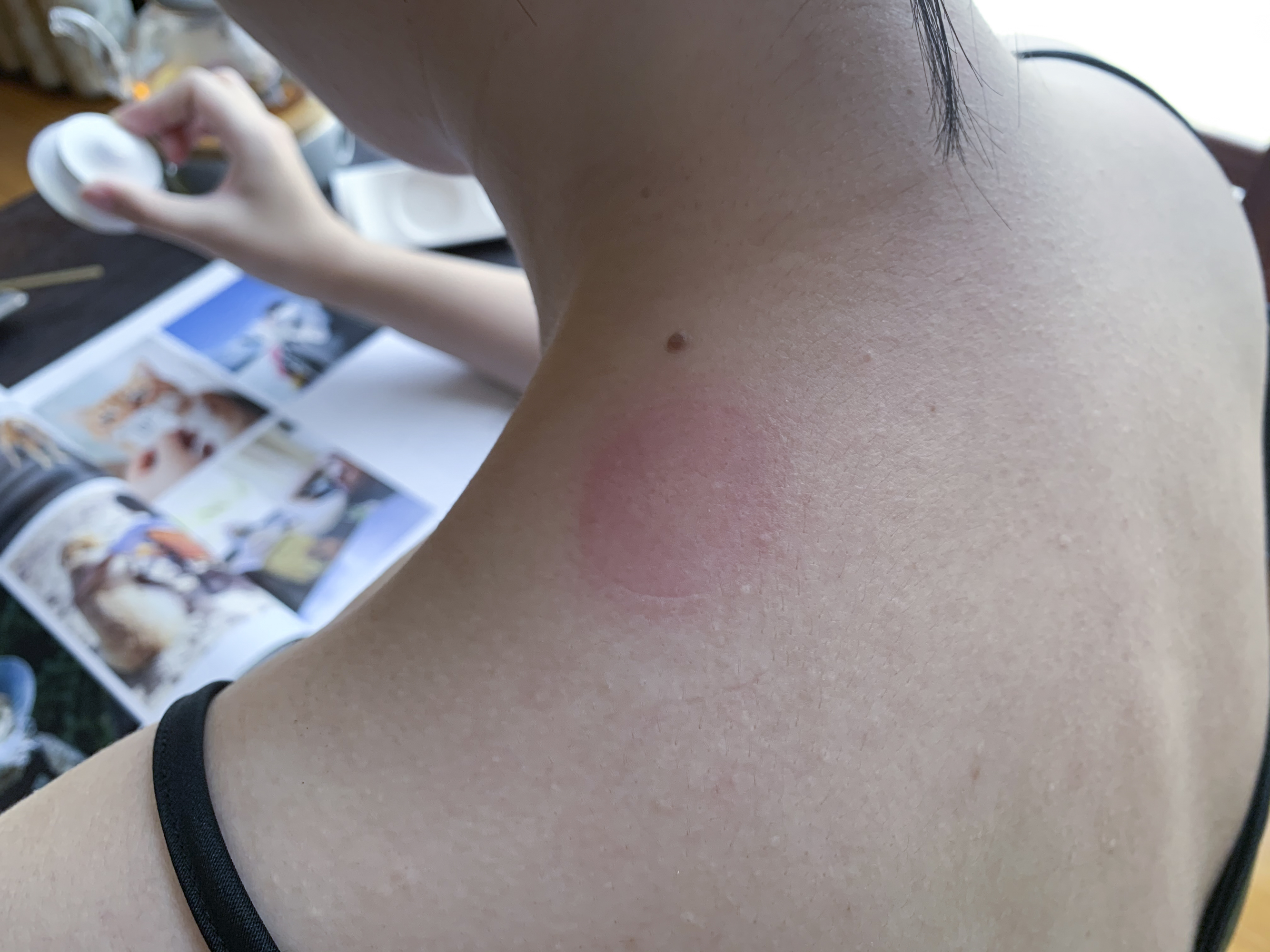 薇新艾灸盒效果图,薇新艾灸盒有用吗