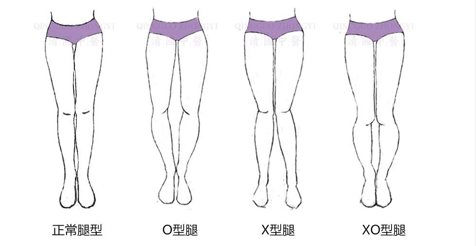 如何坐着改善小腿肌肉外翻,小腿肌肉外翻的严重怎么改变