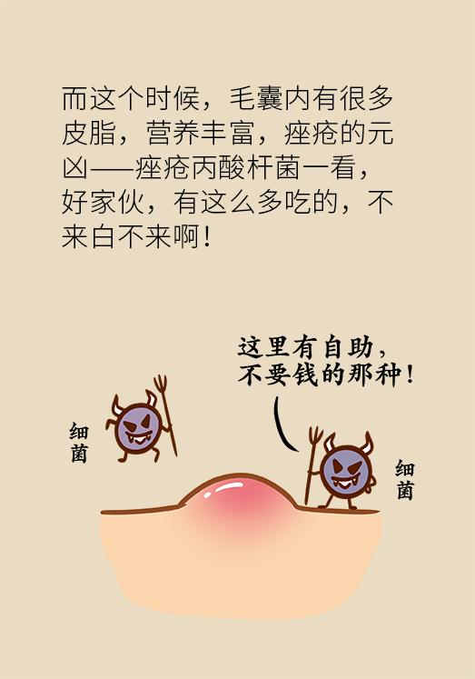 协和医院教你祛痘,长痘别着急中医祛痘秘方来帮你