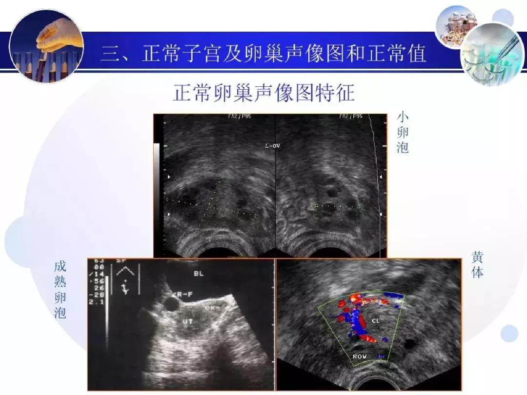 纯干货！子宫及附件解剖和超声诊断