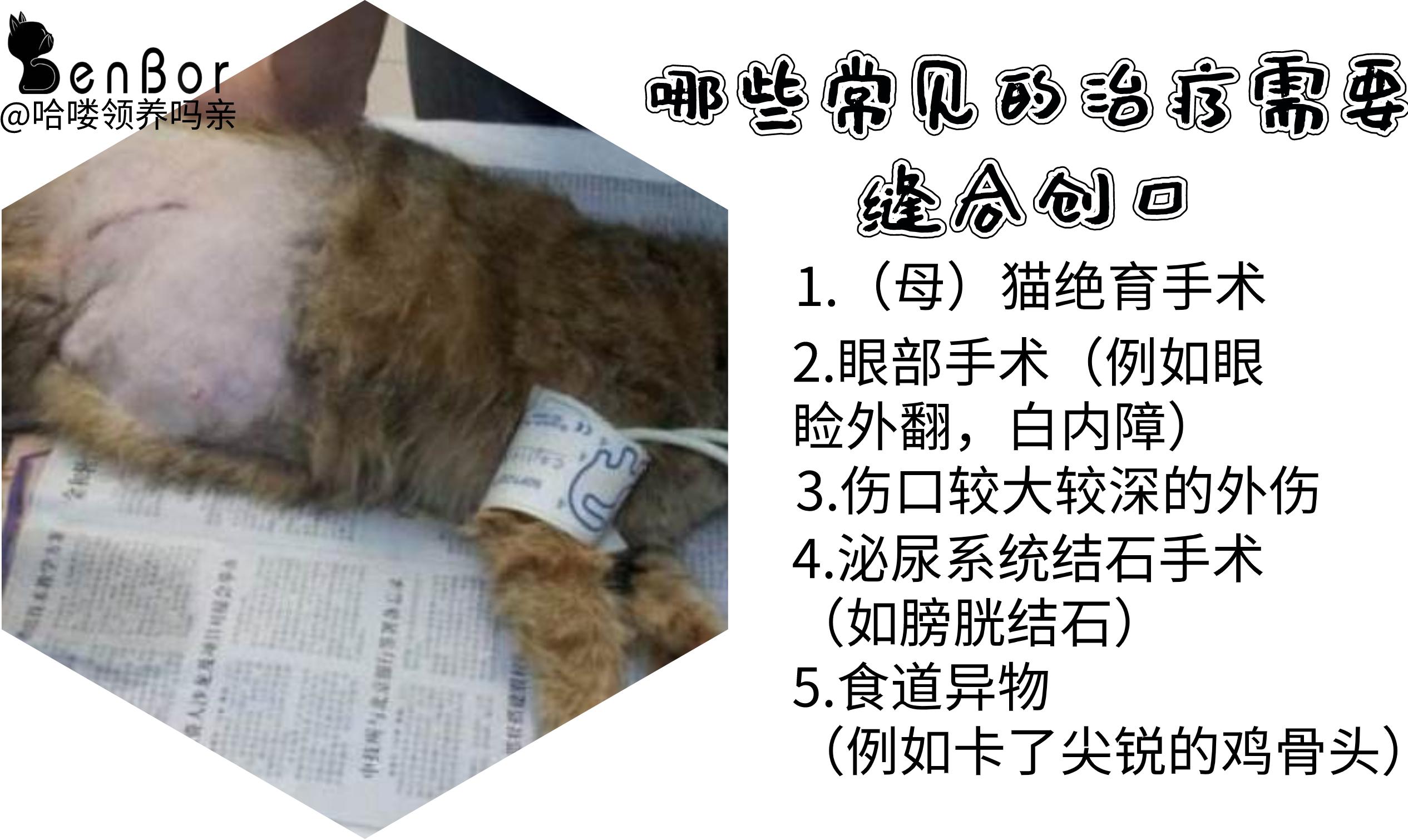 免拆线到底是拆还是不拆好,免拆线和普通线的利弊