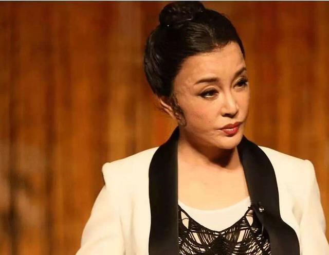 为什么现在女人都喜欢打玻尿酸,长期打玻尿酸10年后的女人