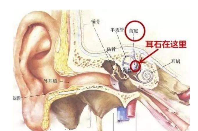 头晕怎么区分高血压还是颈椎病,颈椎病头晕和高血压头晕区别