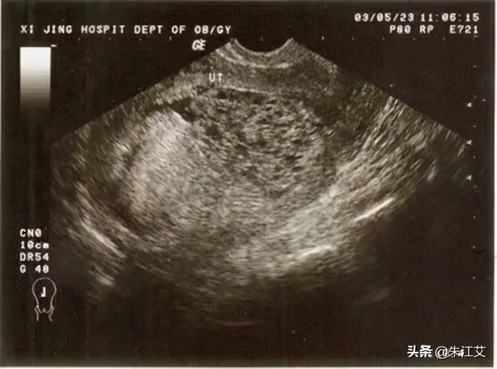 孕期出血一般是什么原因,孕期出血什么原因导致的