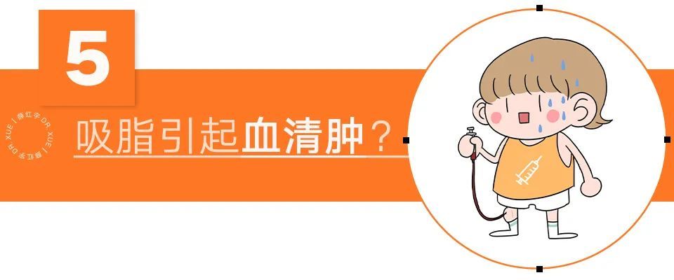 吸脂须知,吸脂必知