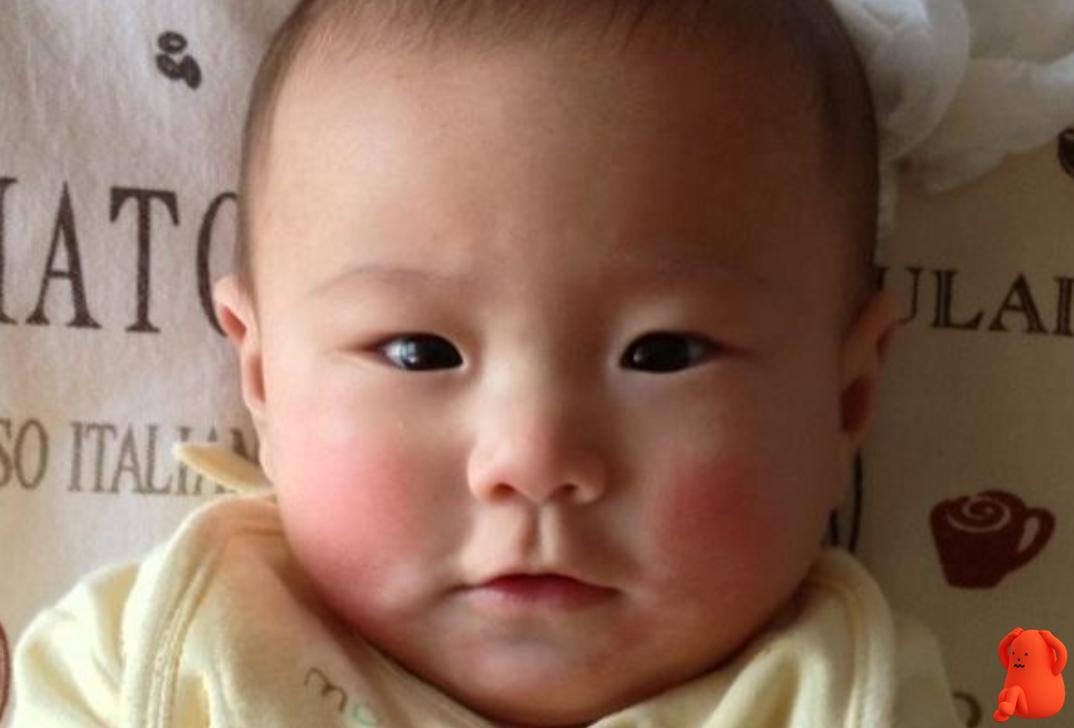 夏季宝宝脸蛋红并粗糙怎么样缓解,宝宝皮肤薄怎么改善