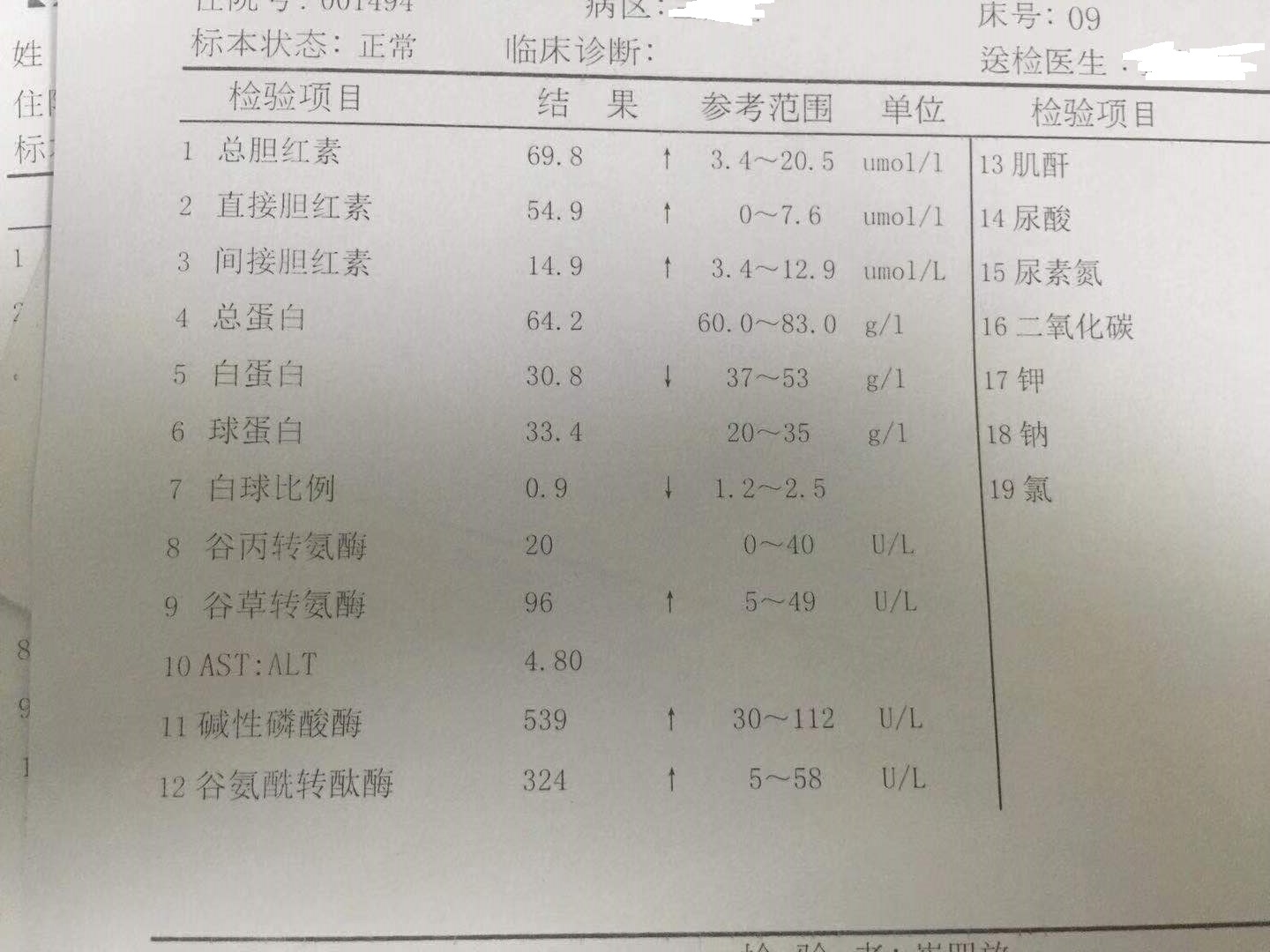 吃立妥普停药血脂也会反弹吗,吃立普妥降脂不太理想怎么办