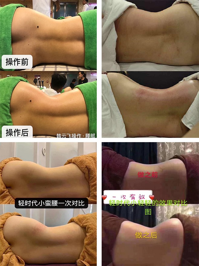 瘦身产品轻时代效果为何这么好