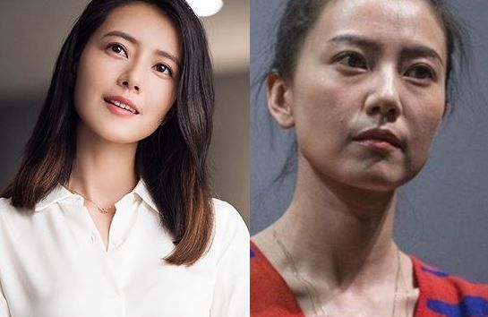 这条鼻唇沟，年龄涨15岁！皮肤保养可不能忽视这里！高圆圆的秘密