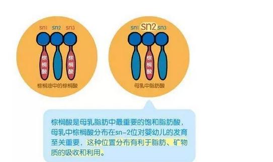 奶粉喂养宝宝便秘怎么回事,奶粉喂养是不是容易便秘