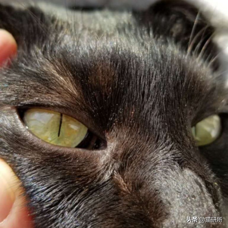 眼睑角膜炎怎么引起的,眼睑炎为什么老是犯